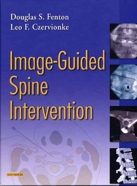 Image Guided Spine Intervention