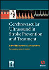Cerebrovascular Ultrasound and Stroke Management