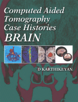 Computed Aided Tomography Case Histories: Brain