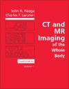 CT and MR Imaging of the Whole Body