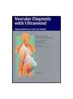 Vascular Diagnosis With Ultrasound : Clinical References With Case Studies