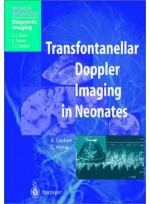 Transfontanellar Doppler Imaging in Neonates