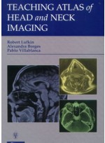 Teaching Atlas of Head and Neck Imaging