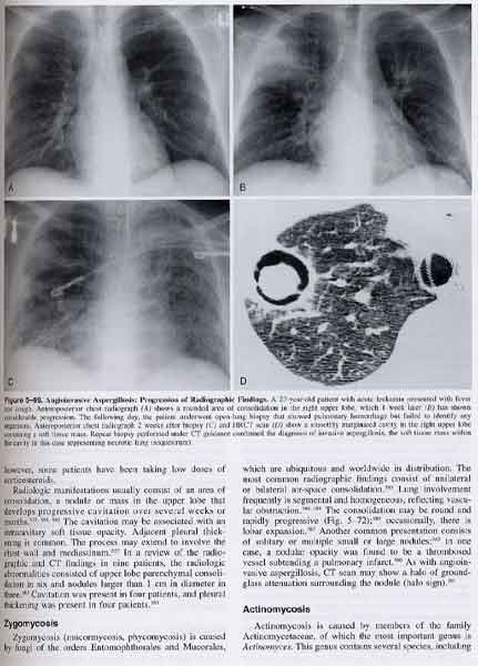 Radiologic Diagnosis of Diseases of the Chest