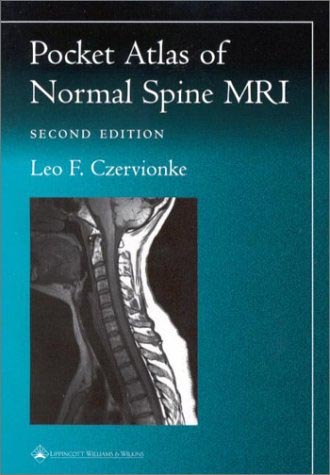 Pocket Atlas of Normal Spinal Mri