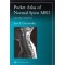 Pocket Atlas of Normal Spinal Mri