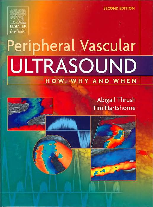 Peripheral Vascular Ultrasound