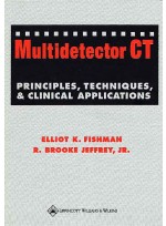 Multidetector Computed Tomography : Principles, Techniques, and Clinical Applications