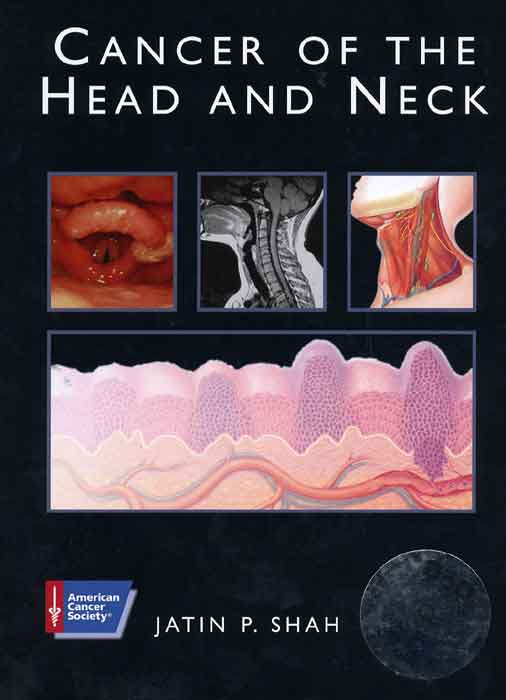 American Cancer Society Atlas of Clinical Oncology: Cancer of the Head and Neck (Book with CD-ROM)