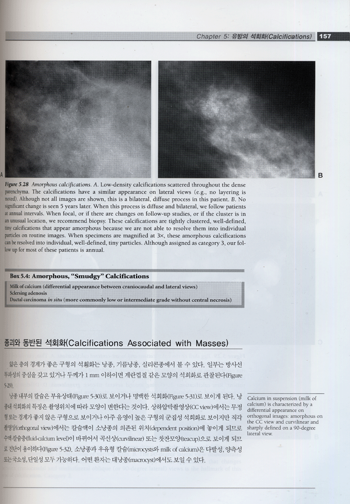 유방영상학 : Breast Imaging