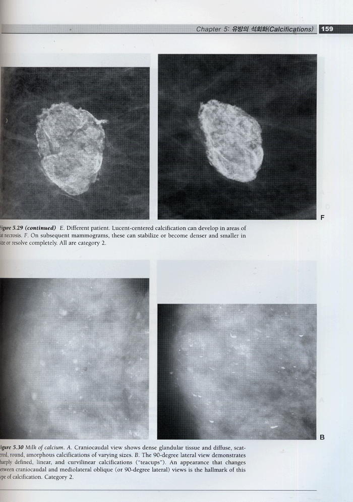 유방영상학 : Breast Imaging