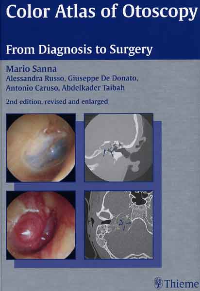 Color Atlas of Otoscopy: From Diagnosis to Surgery