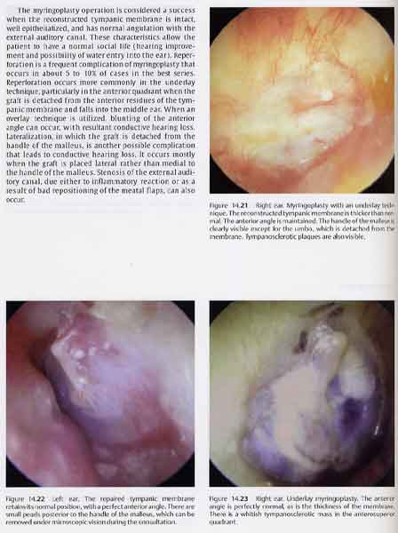 Color Atlas of Otoscopy: From Diagnosis to Surgery