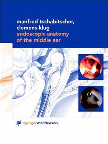 Endoscopic Anatomy of the Middle Ear