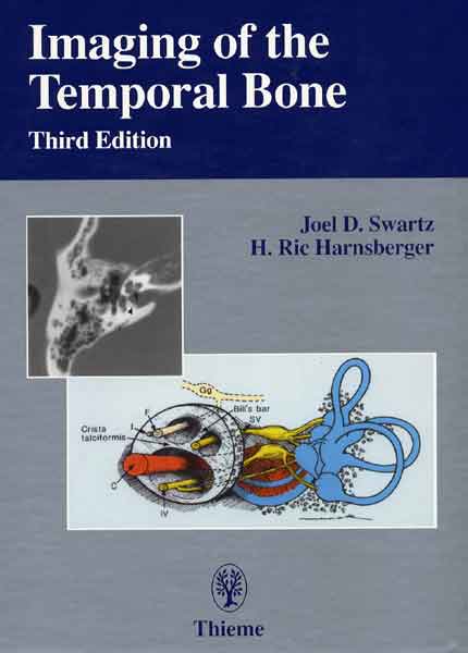 Imaging of the Temporal Bone