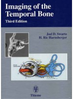 Imaging of the Temporal Bone