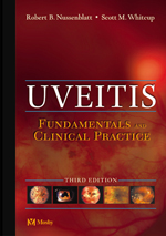 Uveitis,3/e