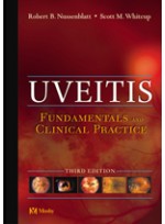 Uveitis,3/e