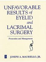 Unfavorable Results of Eyelid and Lacrimal Surgery Prevention and Management