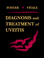 Diagnosis & Treatment of Uvietis