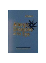 Allergic Diseases of the Eye
