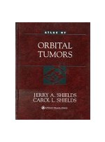 Atlas of Orbital Tumors