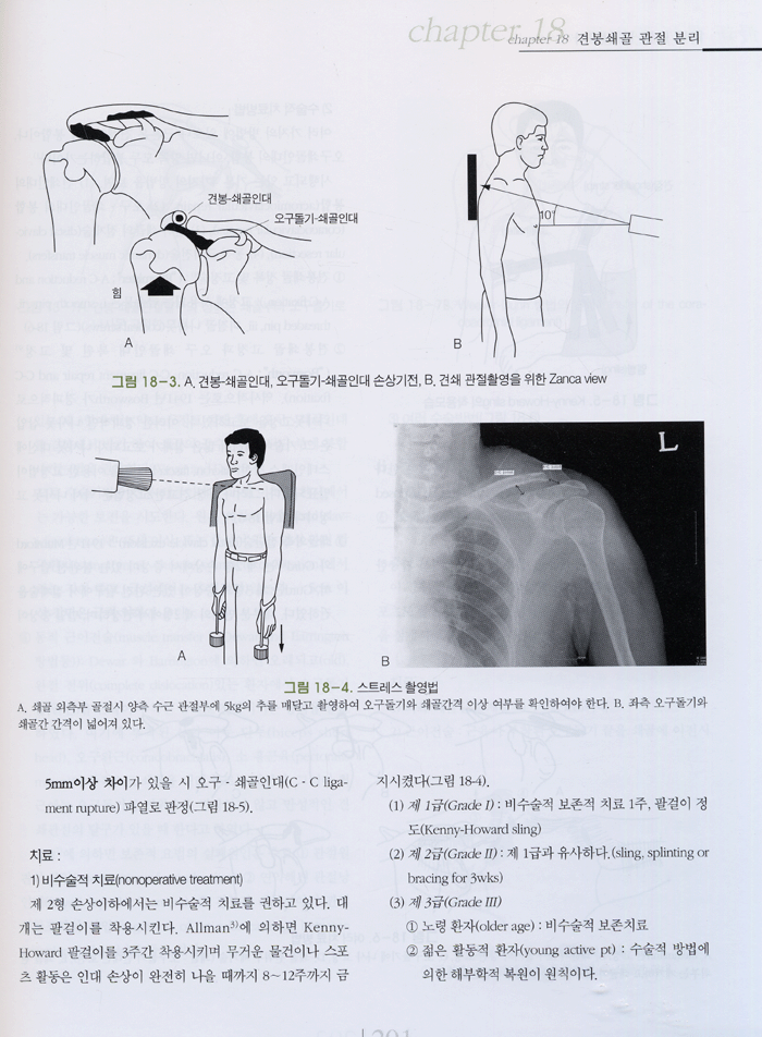 최신 골절 및 탈구학 3판