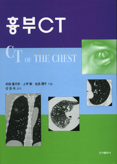 흉부 CT 2판