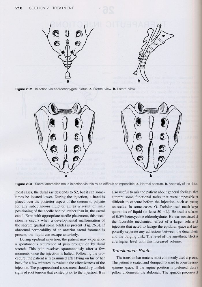 Diagnosis And Treatment Of Pain Of Vertebral Origin 2th