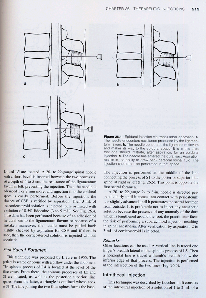 Diagnosis And Treatment Of Pain Of Vertebral Origin 2th