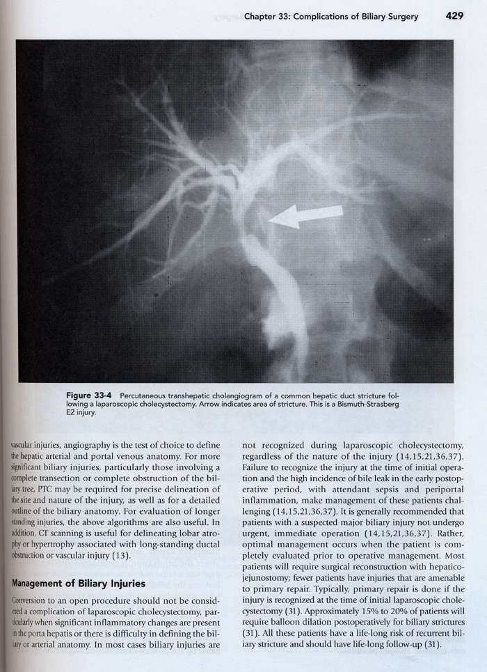 Complications in Surgery ,1/e