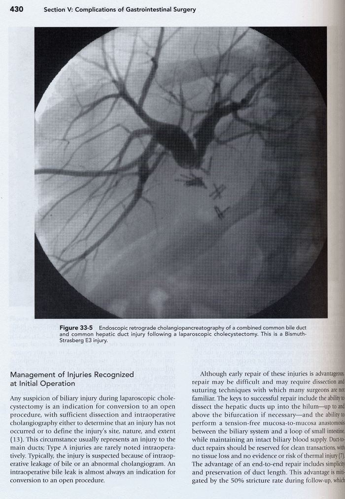 Complications in Surgery ,1/e