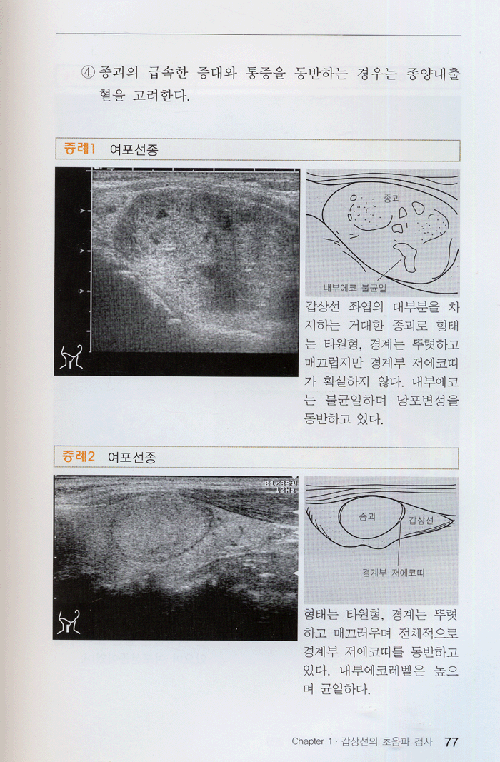 갑상선ㆍ부갑상선 타액선 초음파영상