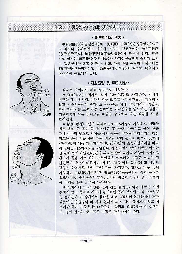 경혈에 침 놓는 요령