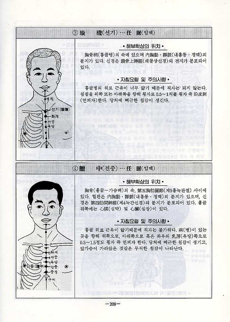 경혈에 침 놓는 요령