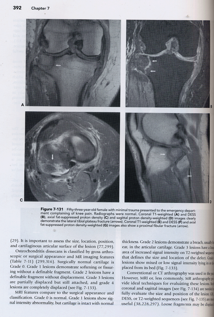 MRI of the Musculoskeletal System (5e)