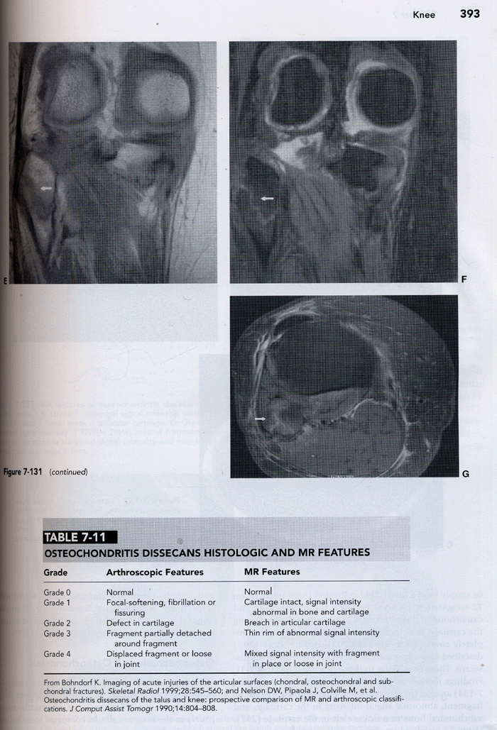 MRI of the Musculoskeletal System (5e)