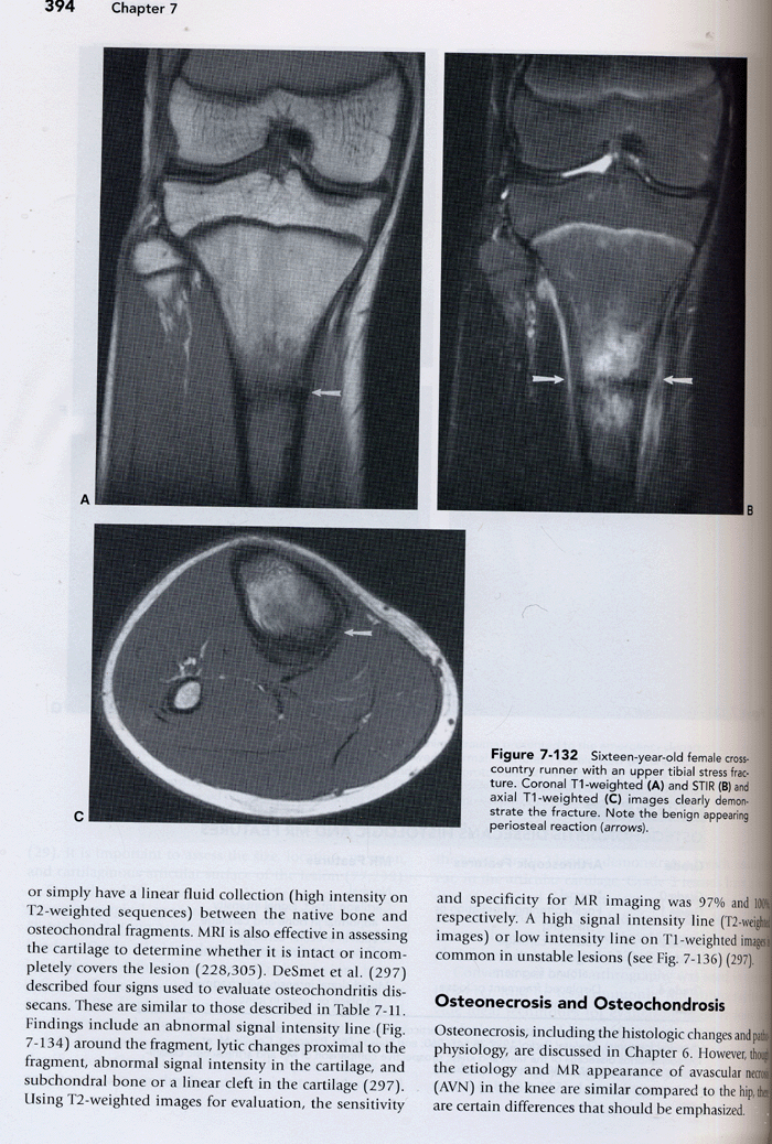 MRI of the Musculoskeletal System (5e)