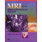 MRI of the Musculoskeletal System (5e)