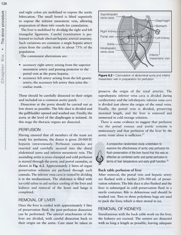 Transplantation:A Companion to Specialist Surgical Practice ,3/e