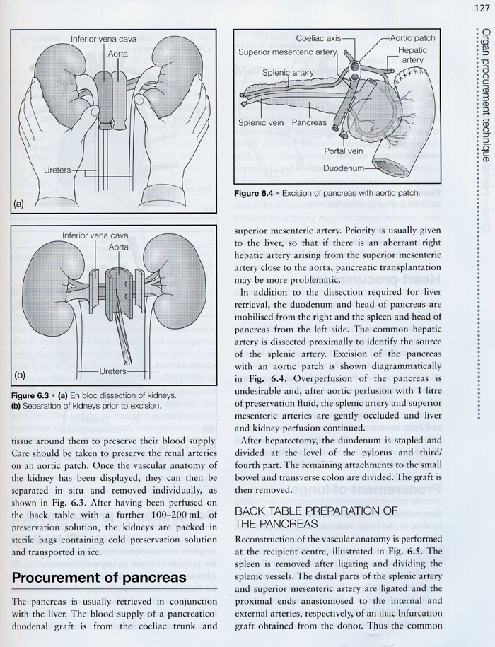 Transplantation:A Companion to Specialist Surgical Practice ,3/e