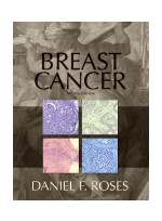 Breast Cancer,2/e