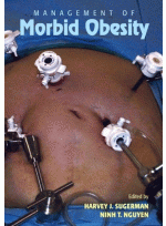 Management of Morbid Obesity