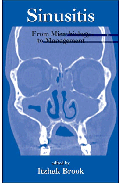 Sinusitis: From Microbiology To Management