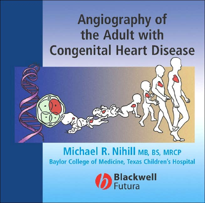 Angiography of the Adult with Congenital Heart Disease