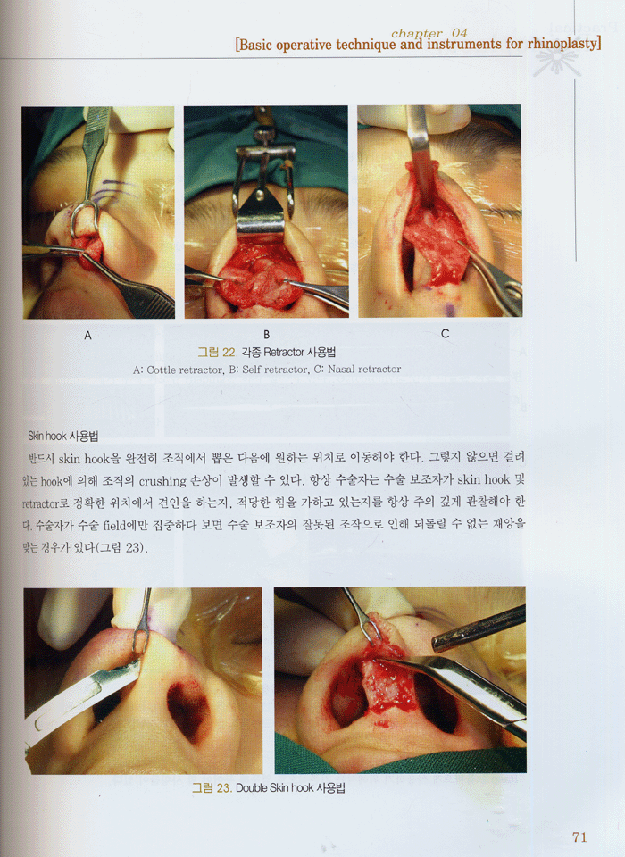 PRACTICAL RHINOPLASTY (코성형술)