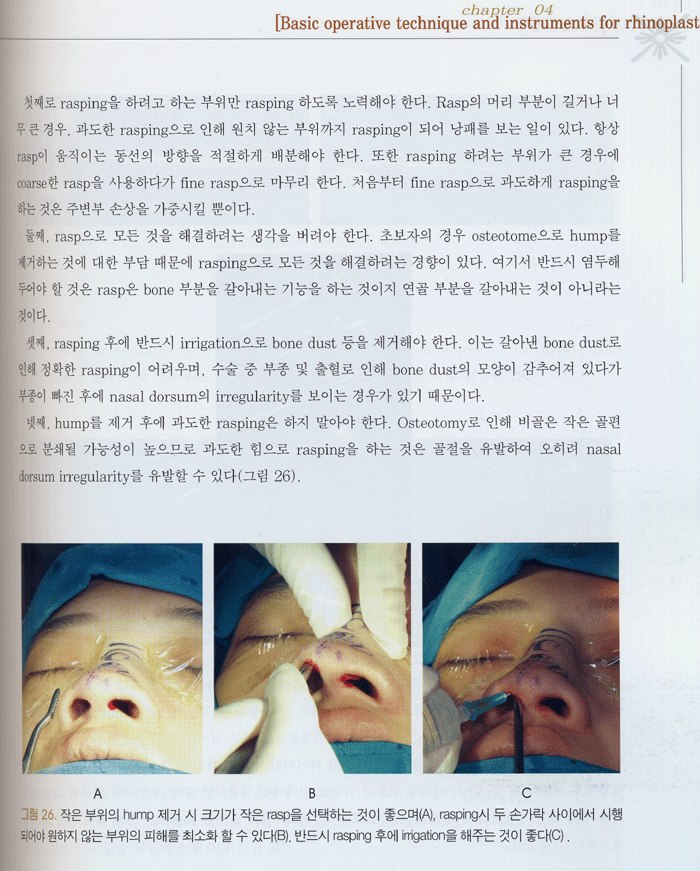 PRACTICAL RHINOPLASTY (코성형술)