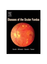 Diseases Of The Ocular Fundus