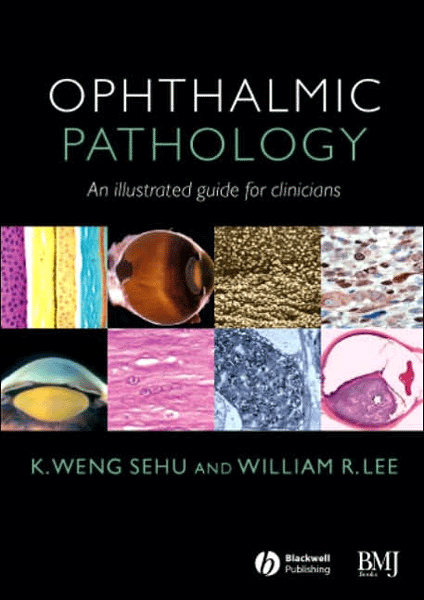 Ophthalmic Pathology An Illustrated Guide for Clinicians