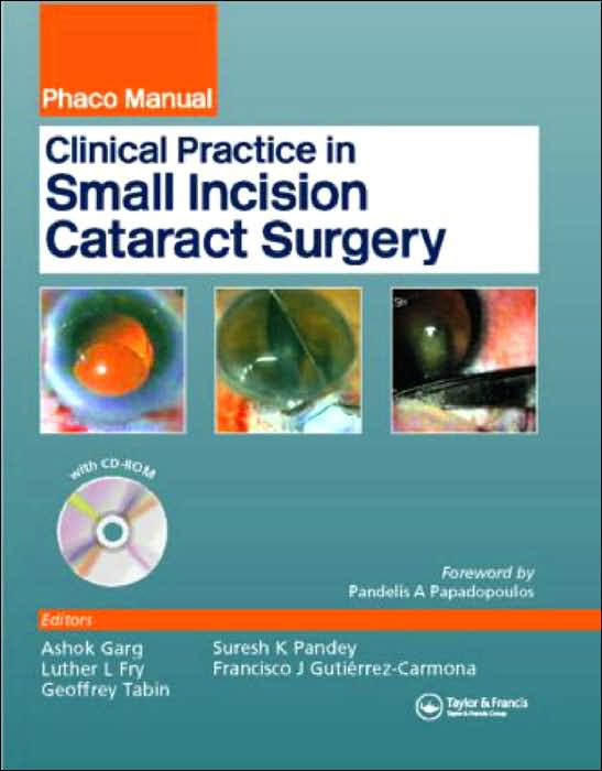 Clinical Practice In Small Incision Cataract Surgery